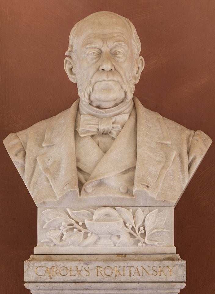 Karl von Rokitansky's bust, University of Vienna (by Julia Rudiger).jpg